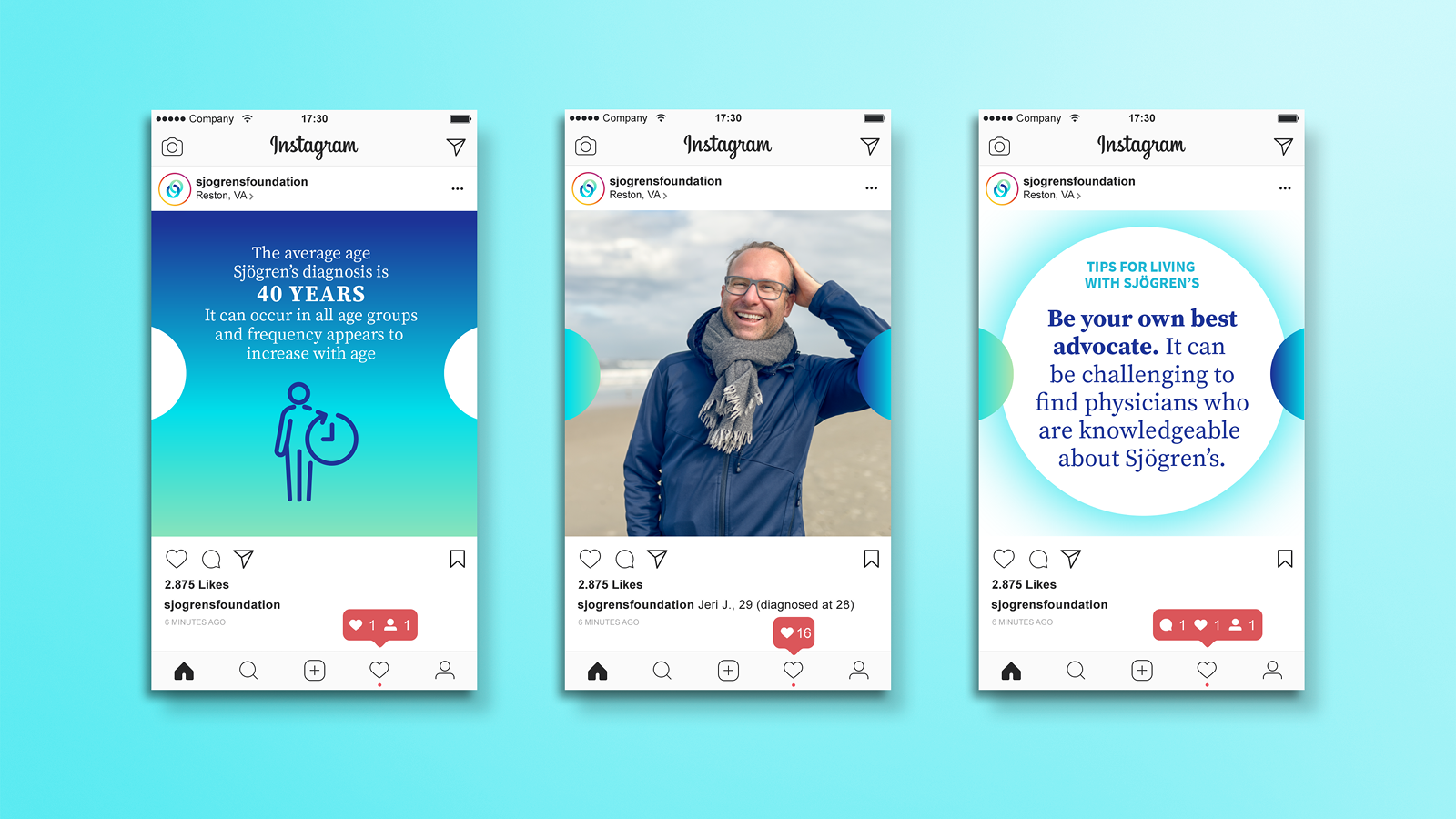 Sjögren's Foundation Instagram Mockups